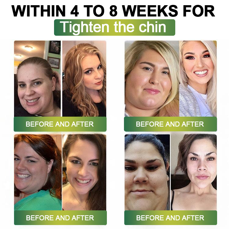 Clinically Proven|Official Store |Lenreey® NIDDK-Tirzepatide Slimming & health NANO MICRONEEDLE PATCH with Collagen & Matrixyl 3000丨Targets Obesity, Loose Skin, High Blood Pressure, Diabetes, Fatty Liver, Joint Pain, and More🌞