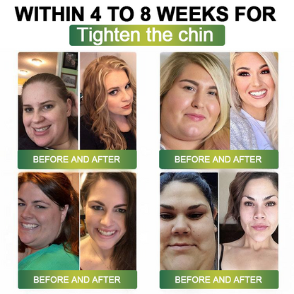 Clinically Proven|Official Store |Lenreey® NIDDK-Tirzepatide Slimming & health NANO MICRONEEDLE PATCH with Collagen & Matrixyl 3000丨Targets Obesity, Loose Skin, High Blood Pressure, Diabetes, Fatty Liver, Joint Pain, and More🌞
