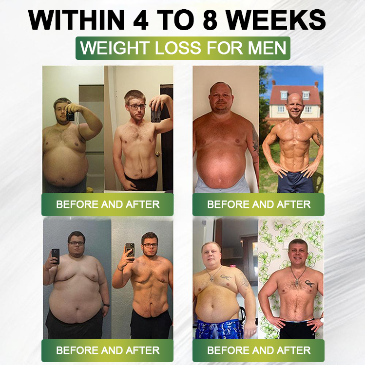 Clinically Proven|Official Store |Lenreey® NIDDK-Tirzepatide Slimming & health NANO MICRONEEDLE PATCH with Collagen & Matrixyl 3000丨Targets Obesity, Loose Skin, High Blood Pressure, Diabetes, Fatty Liver, Joint Pain, and More🌞