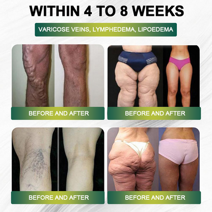 Clinically Proven|Official Store |Lenreey® NIDDK-Tirzepatide Slimming & health NANO MICRONEEDLE PATCH with Collagen & Matrixyl 3000丨Targets Obesity, Loose Skin, High Blood Pressure, Diabetes, Fatty Liver, Joint Pain, and More🌞