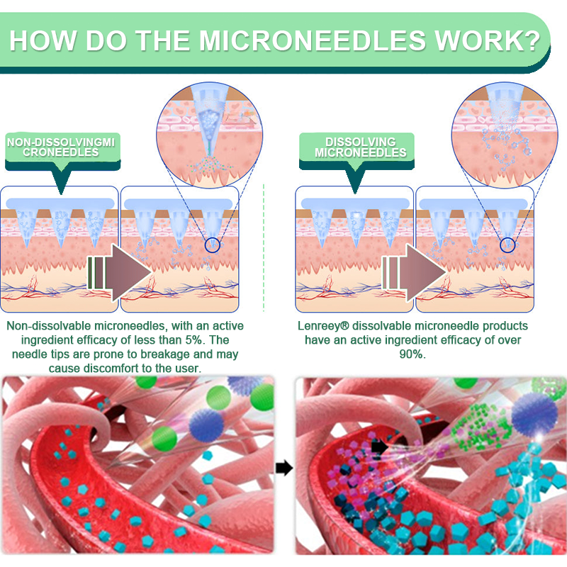 Clinically Proven|Official Store |Lenreey® NIDDK-Tirzepatide Slimming & health NANO MICRONEEDLE PATCH with Collagen & Matrixyl 3000丨Targets Obesity, Loose Skin, High Blood Pressure, Diabetes, Fatty Liver, Joint Pain, and More🌞